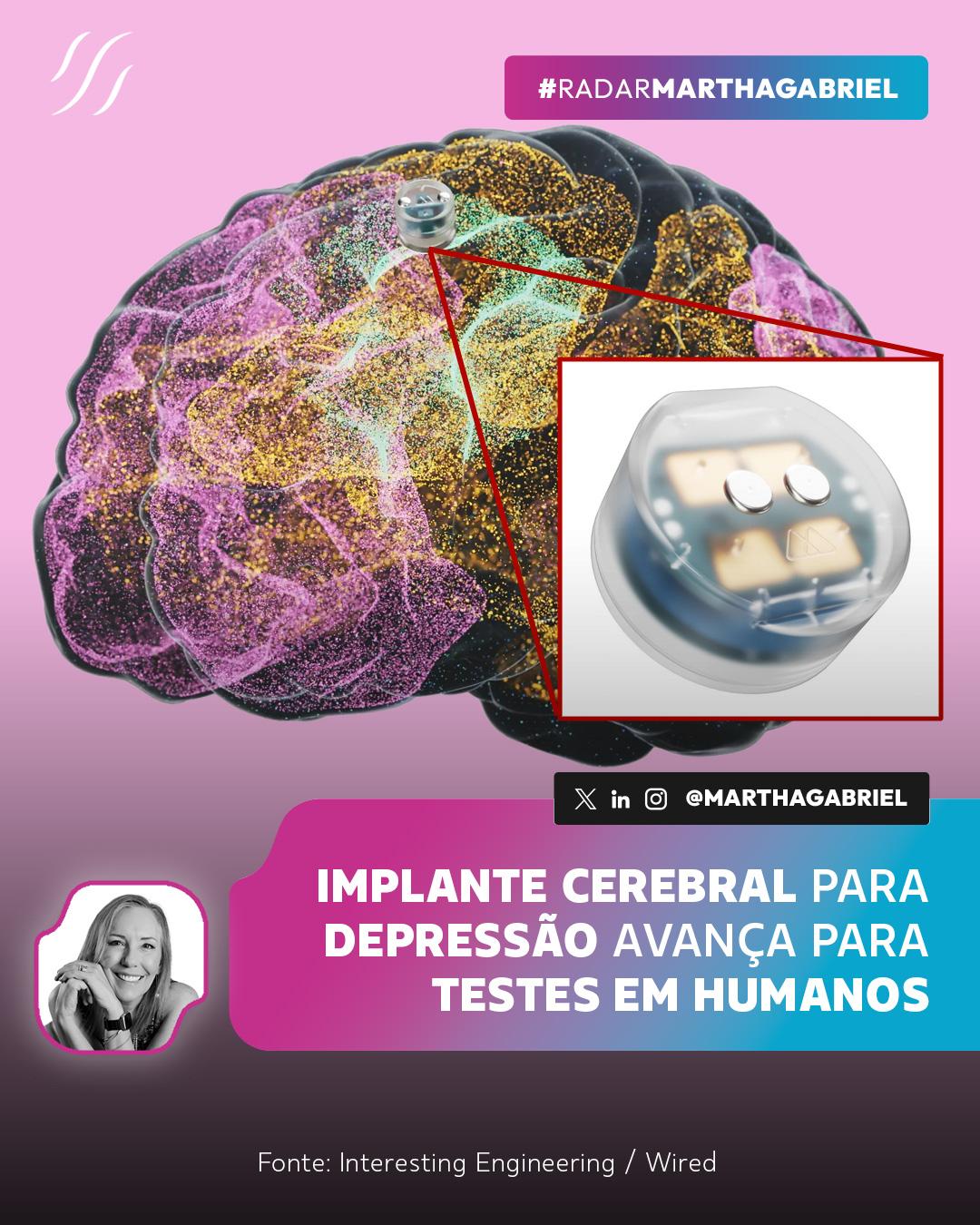 Implante cerebral para depressão avança para testes em humanos