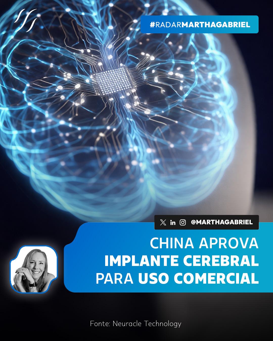 China aprova implante cerebral para uso comercial