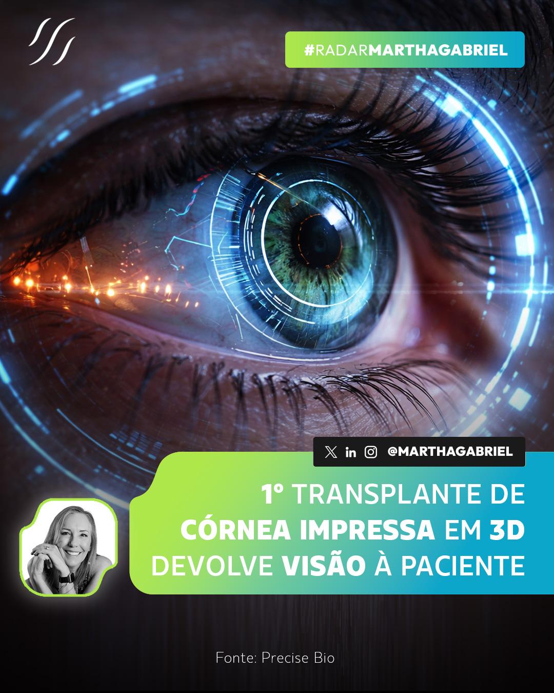1º transplante de córnea impressa em 3D devolve visão à paciente com cegueira