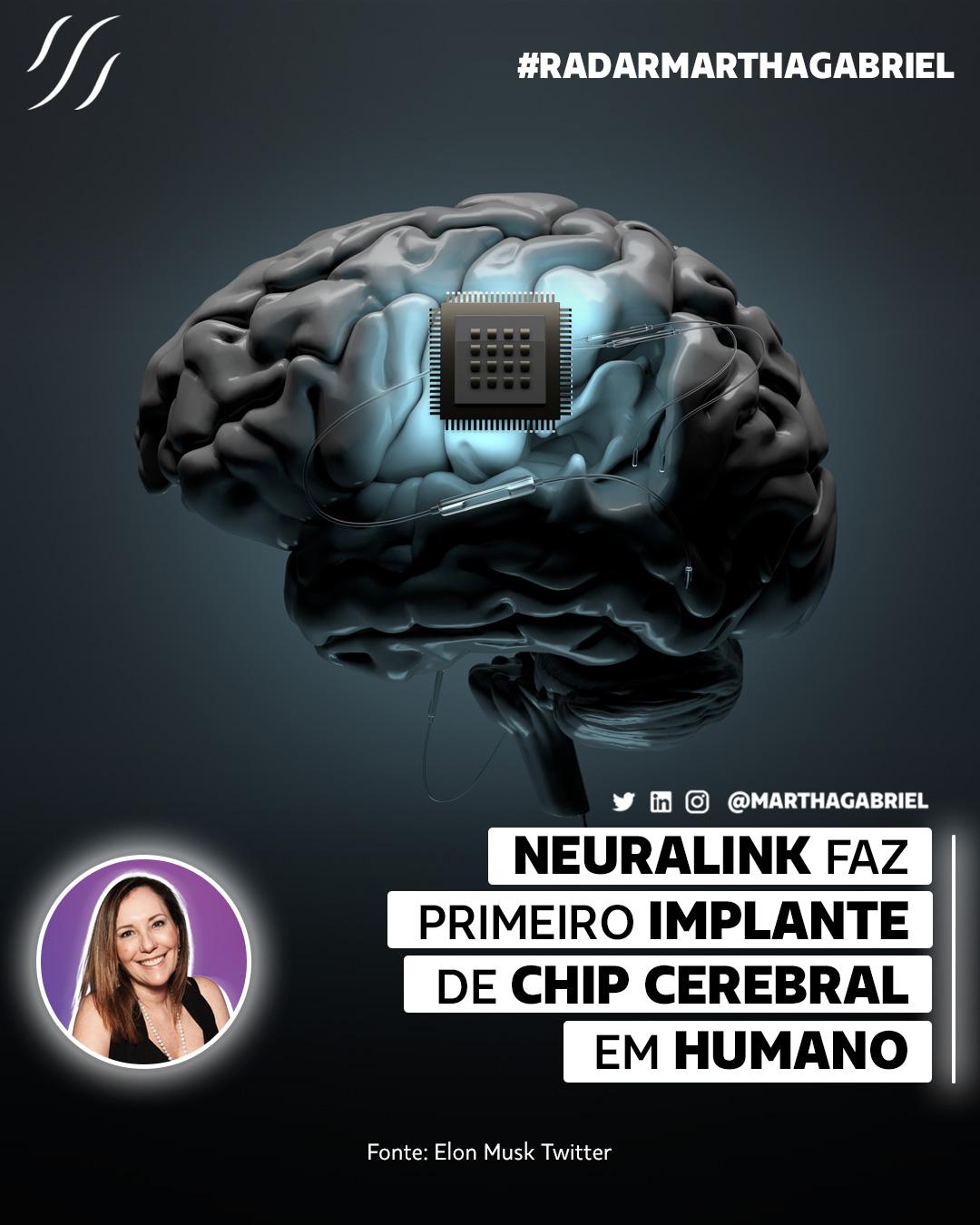Neuralink faz primeiro implante cerebral em humano