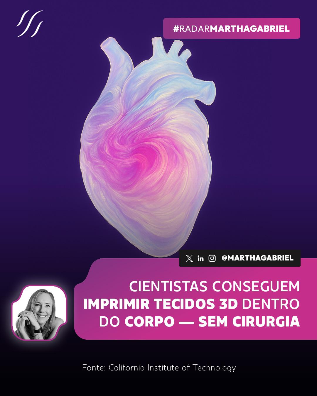 Cientistas conseguem imprimir tecidos 3D dentro do corpo - sem cirurgia