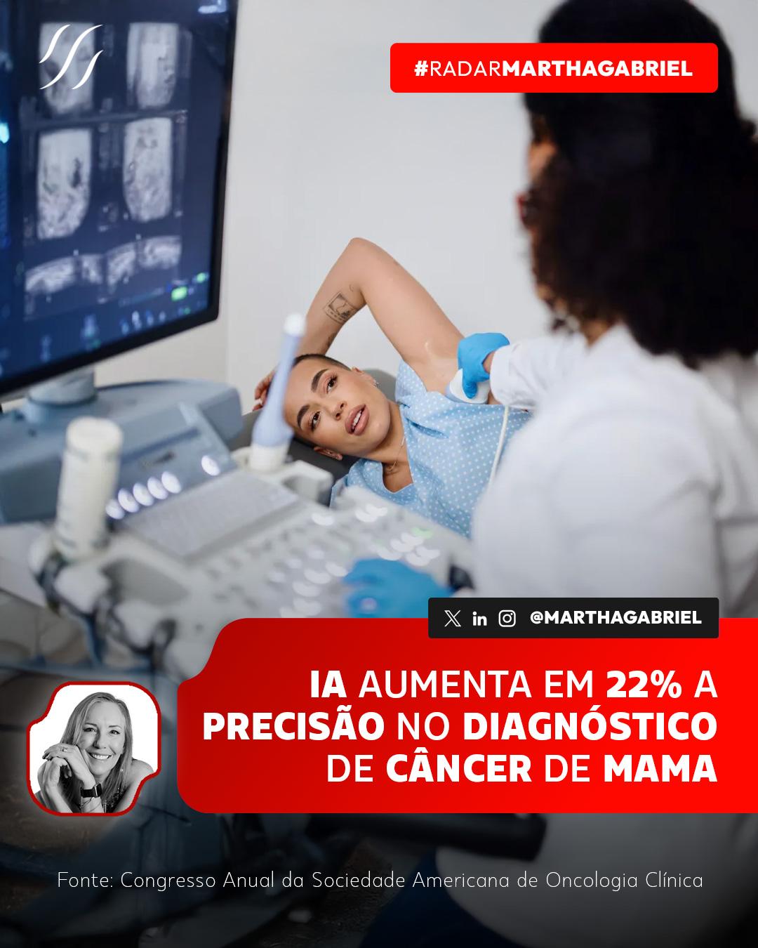 IA aumenta em 22% a precisão no diagnóstico de câncer de mama