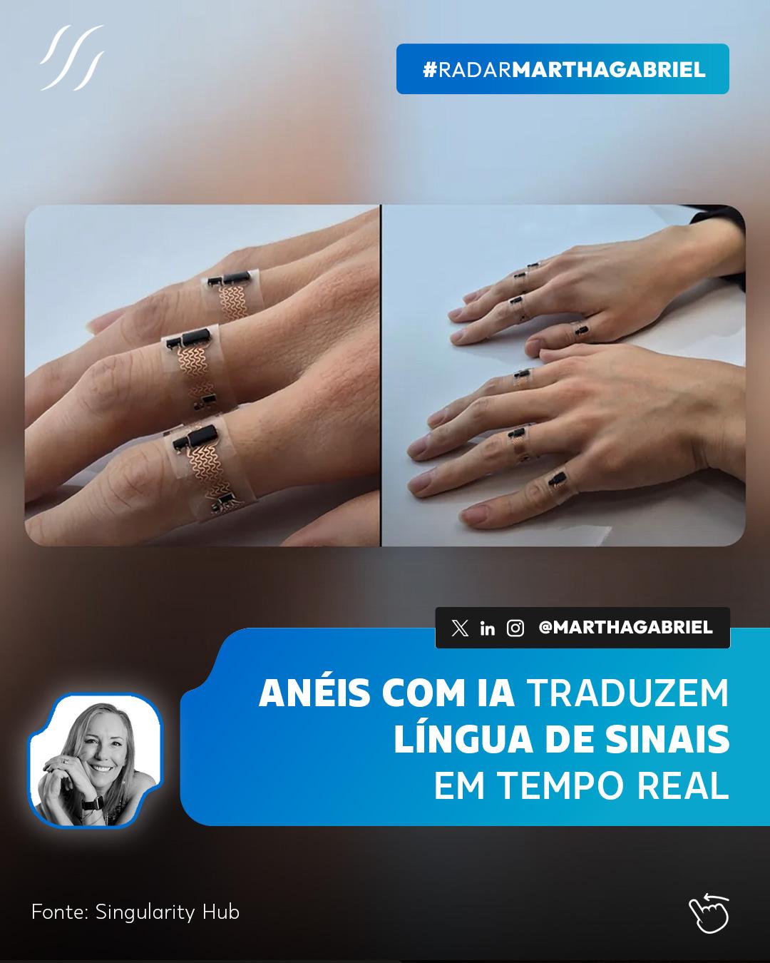 Anéis com IA traduzem língua de sinais em tempo real