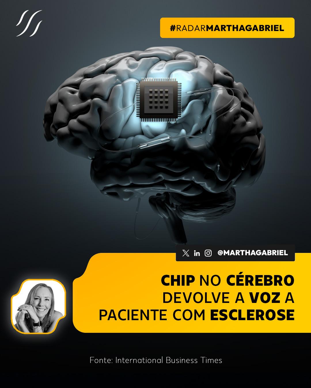 Chip no cérebro devolve a voz a paciente com esclerose