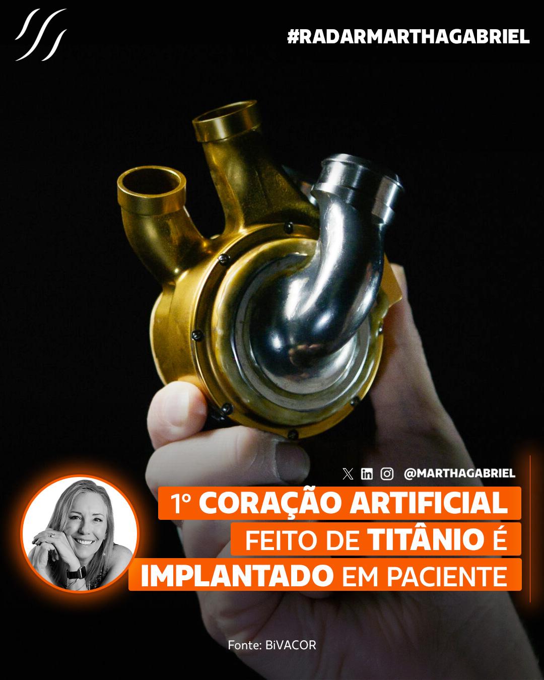 Primeiro coração artificial de titânio é implantado em paciente